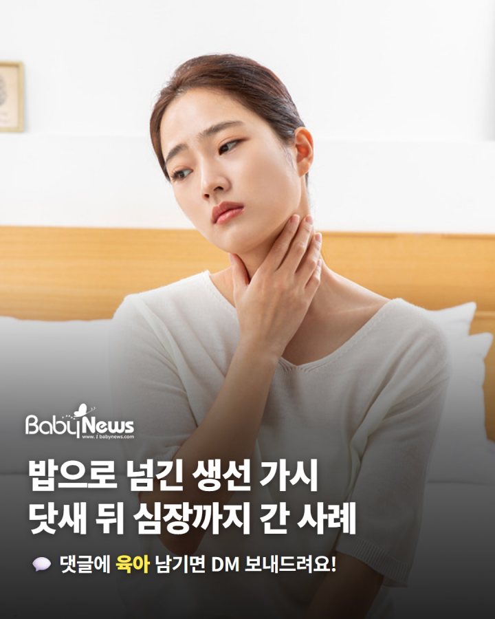 생선 가시 걸려 밥 꿀꺽 삼켰다가… 2.9㎝ 가시가 닷새 뒤 심장까지 간 사례,