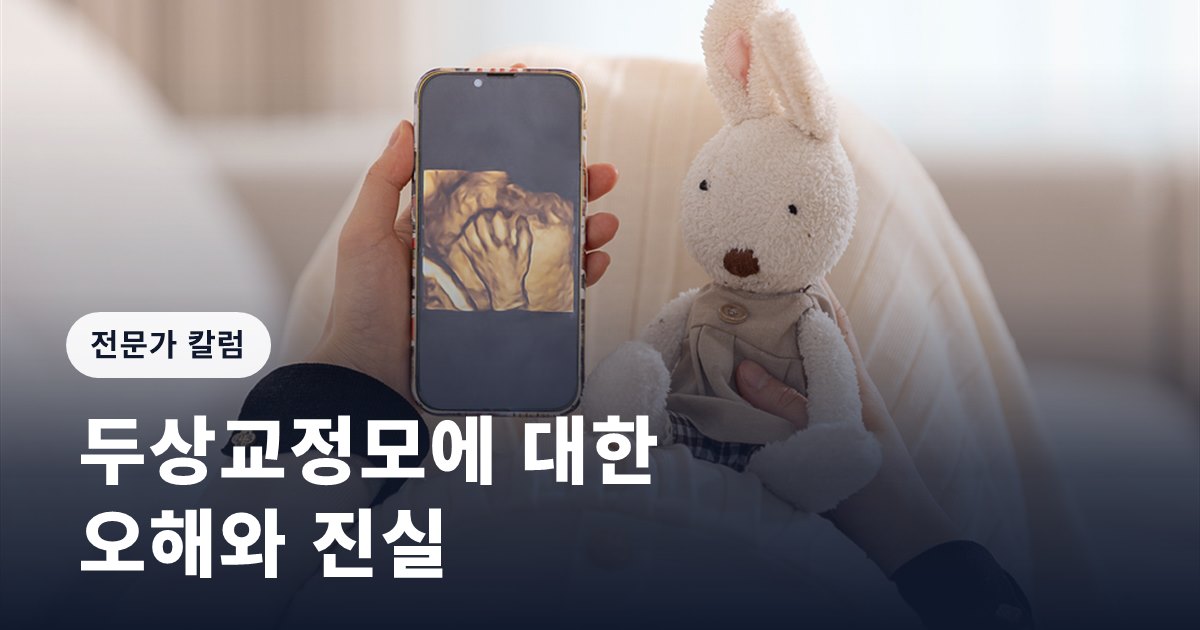 [임신영 칼럼] 두상교정모에 대한 오해와 진실