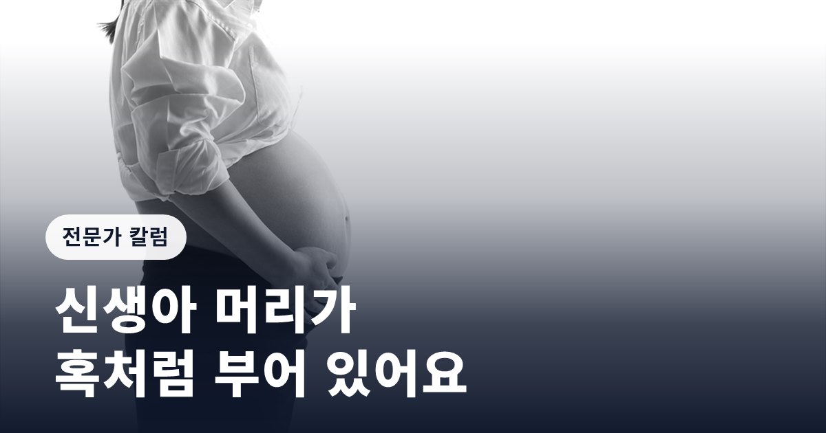 [임신영 칼럼] 신생아 머리가 혹처럼 부어 있어요