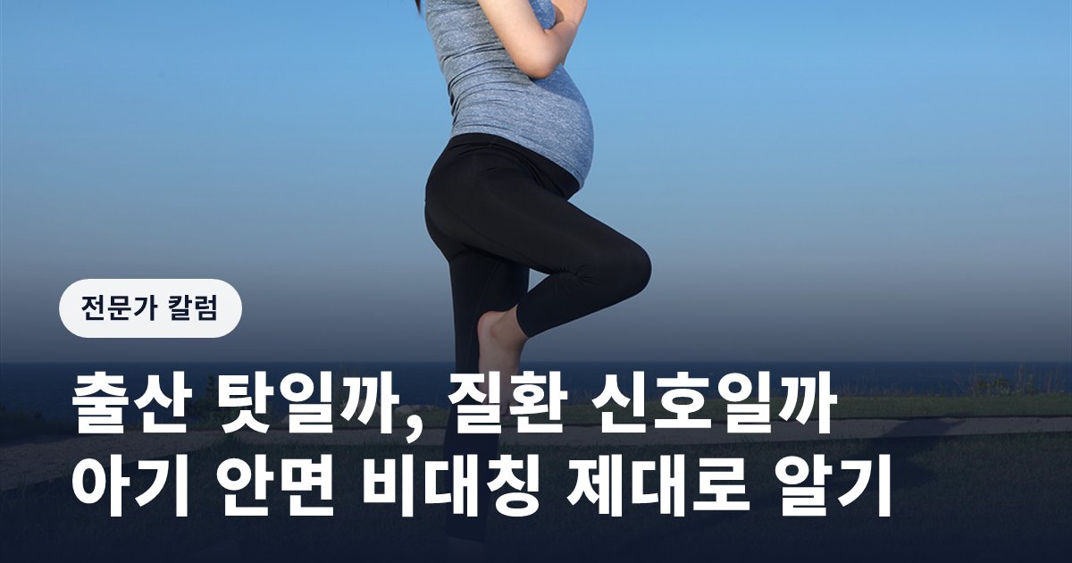 [임신영 칼럼] 출산 탓일까, 질환 신호일까…아기 안면 비대칭 제대로 알기