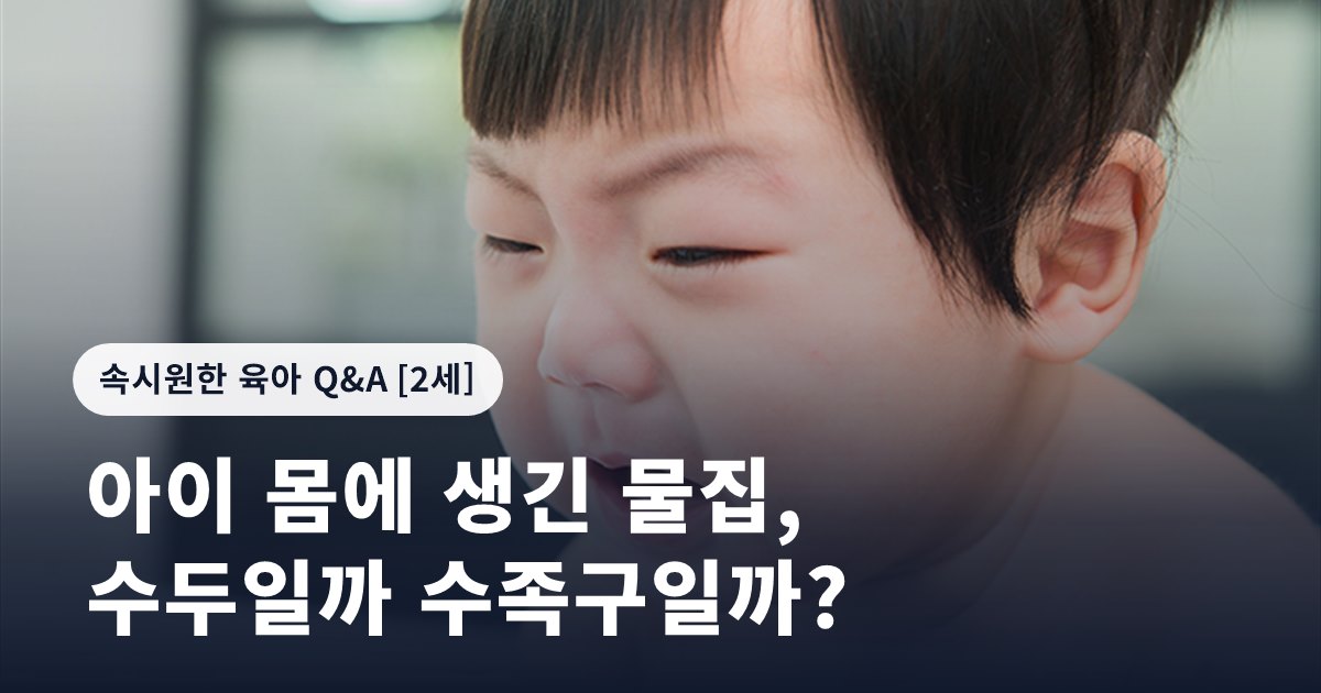 아이 몸에 생긴 물집, 수두일까 수족구일까?