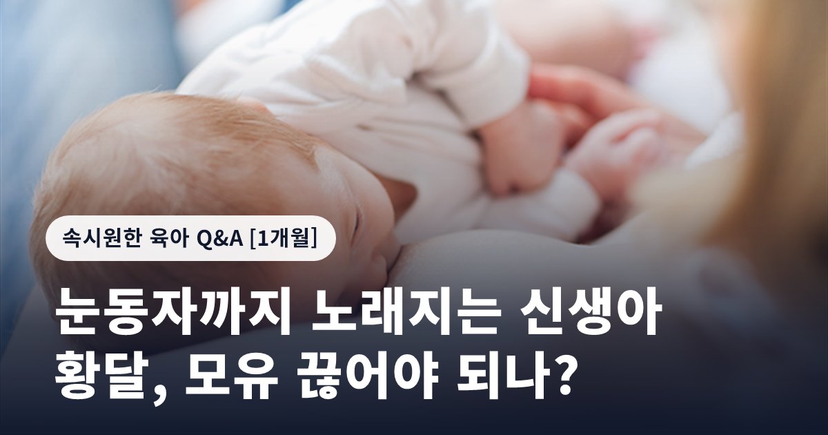 눈동자까지 노래지는 신생아 황달, 모유 끊어야 되나?