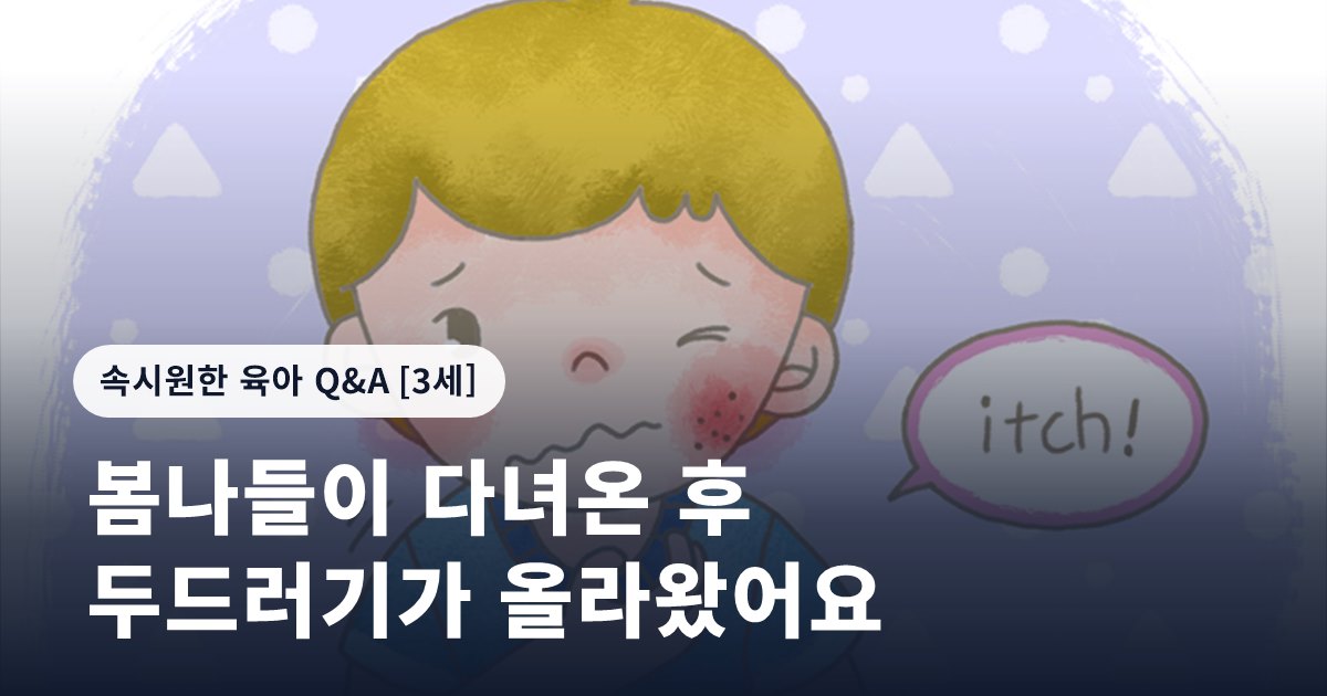 봄나들이 다녀온 후 두드러기가 올라왔어요
