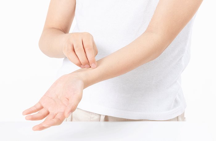아토피 피부염, 무분별한 식이요법 주의하세요!