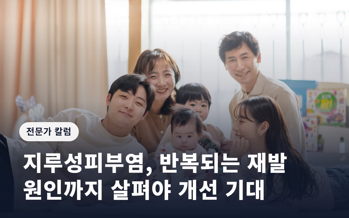 지루성피부염, 반복되는 재발 원인까지 살펴야 개선 기대