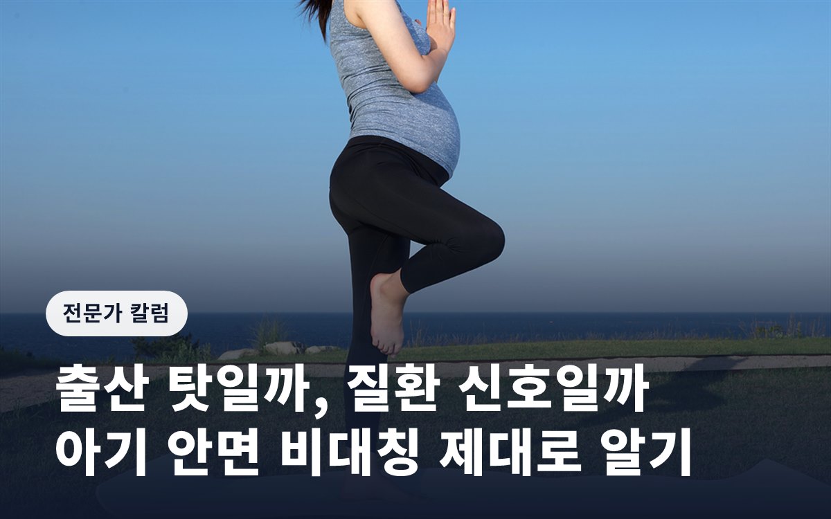 [임신영 칼럼] 출산 탓일까, 질환 신호일까…아기 안면 비대칭 제대로 알기