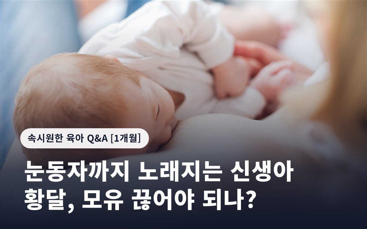 눈동자까지 노래지는 신생아 황달, 모유 끊어야 되나?