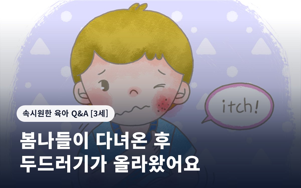 봄나들이 다녀온 후 두드러기가 올라왔어요