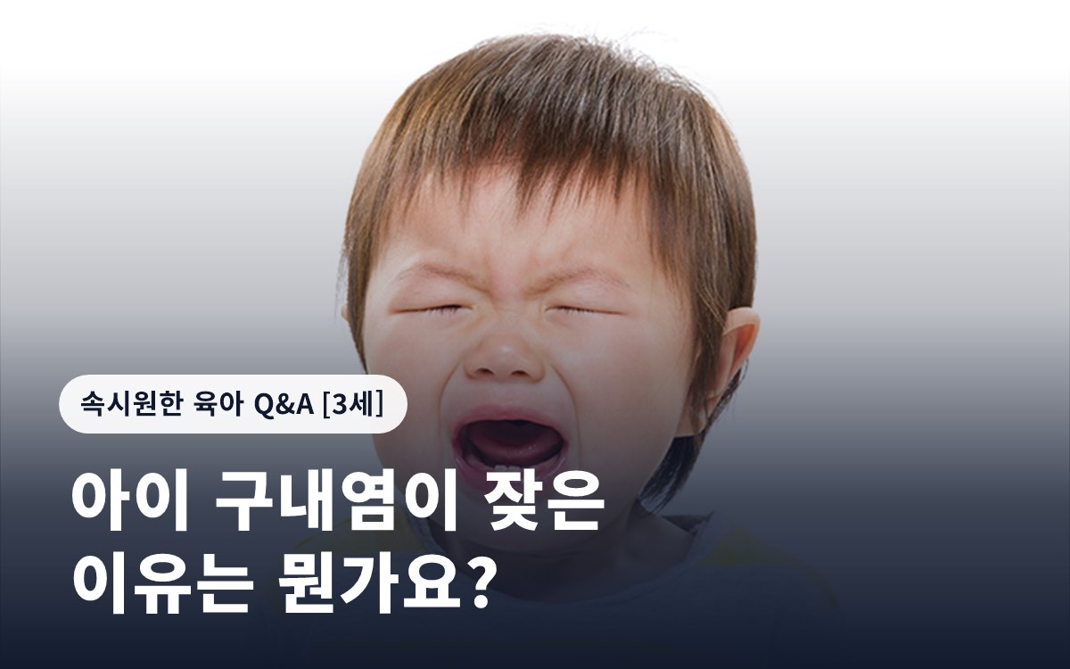 아이 구내염이 잦은 이유는 뭔가요?